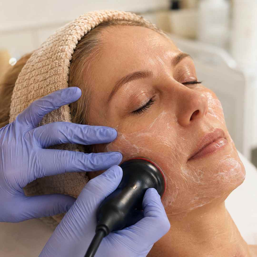 Indiba Facial en Granada